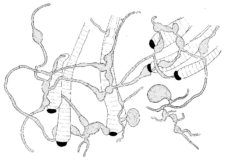 polycentric-chytrid-feeding-on-filamentous-cyanobacteria-after-karling-1977.png